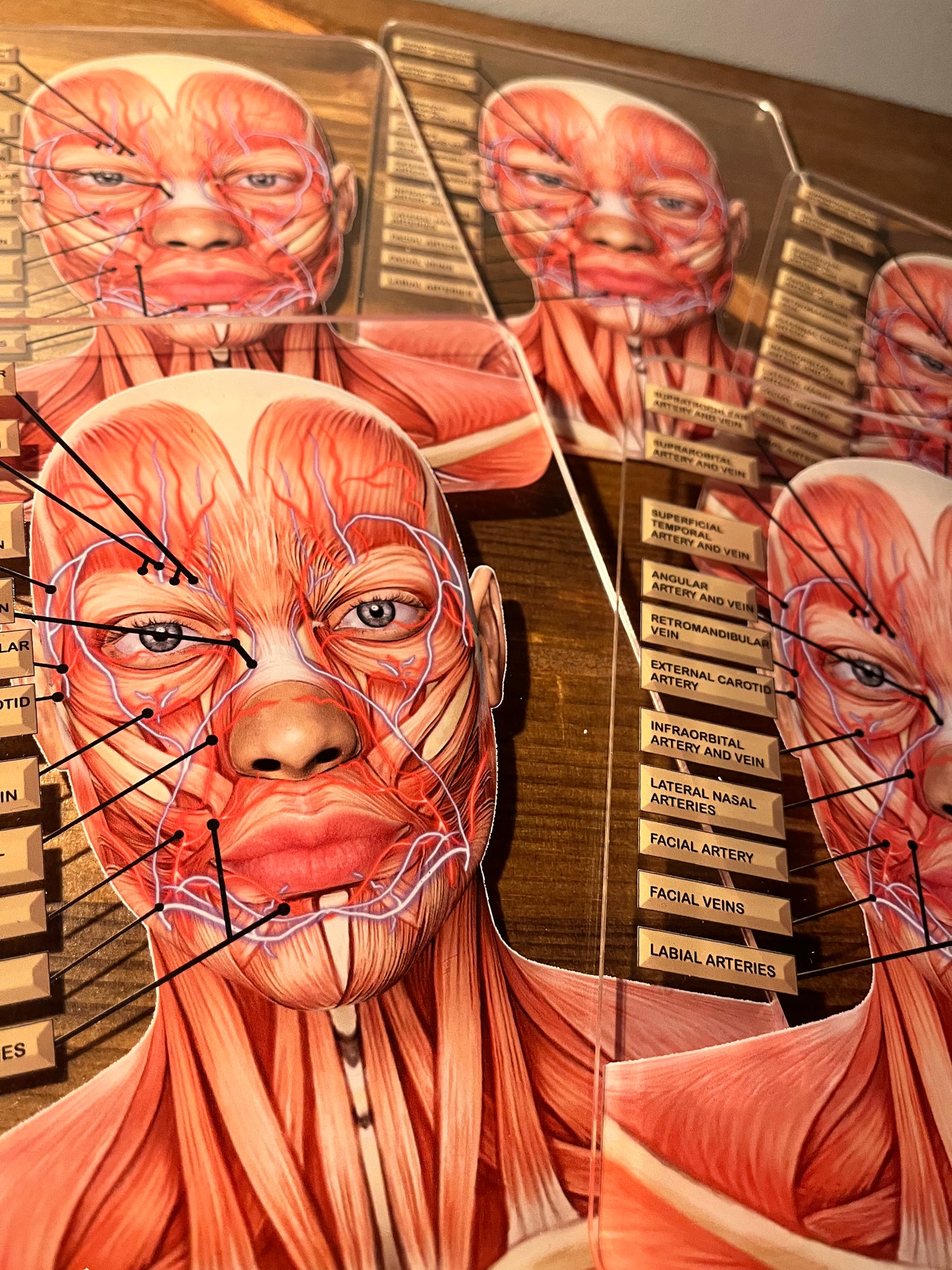MINI's - Aesthetics Training Academy / Consultation Facial Anatomy Graphic for Veins And Arteries. Botox & Filler