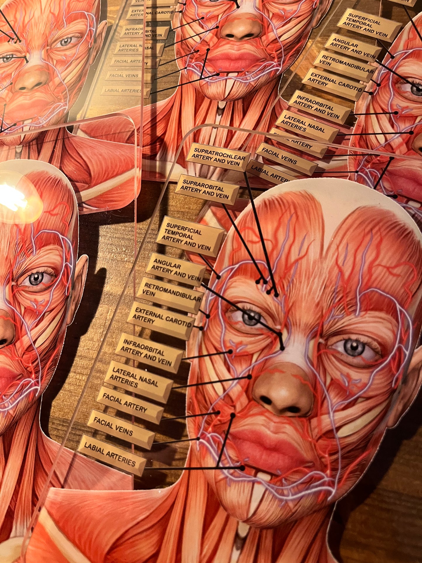 MINI's - Aesthetics Training Academy / Consultation Facial Anatomy Graphic for Veins And Arteries. Botox & Filler