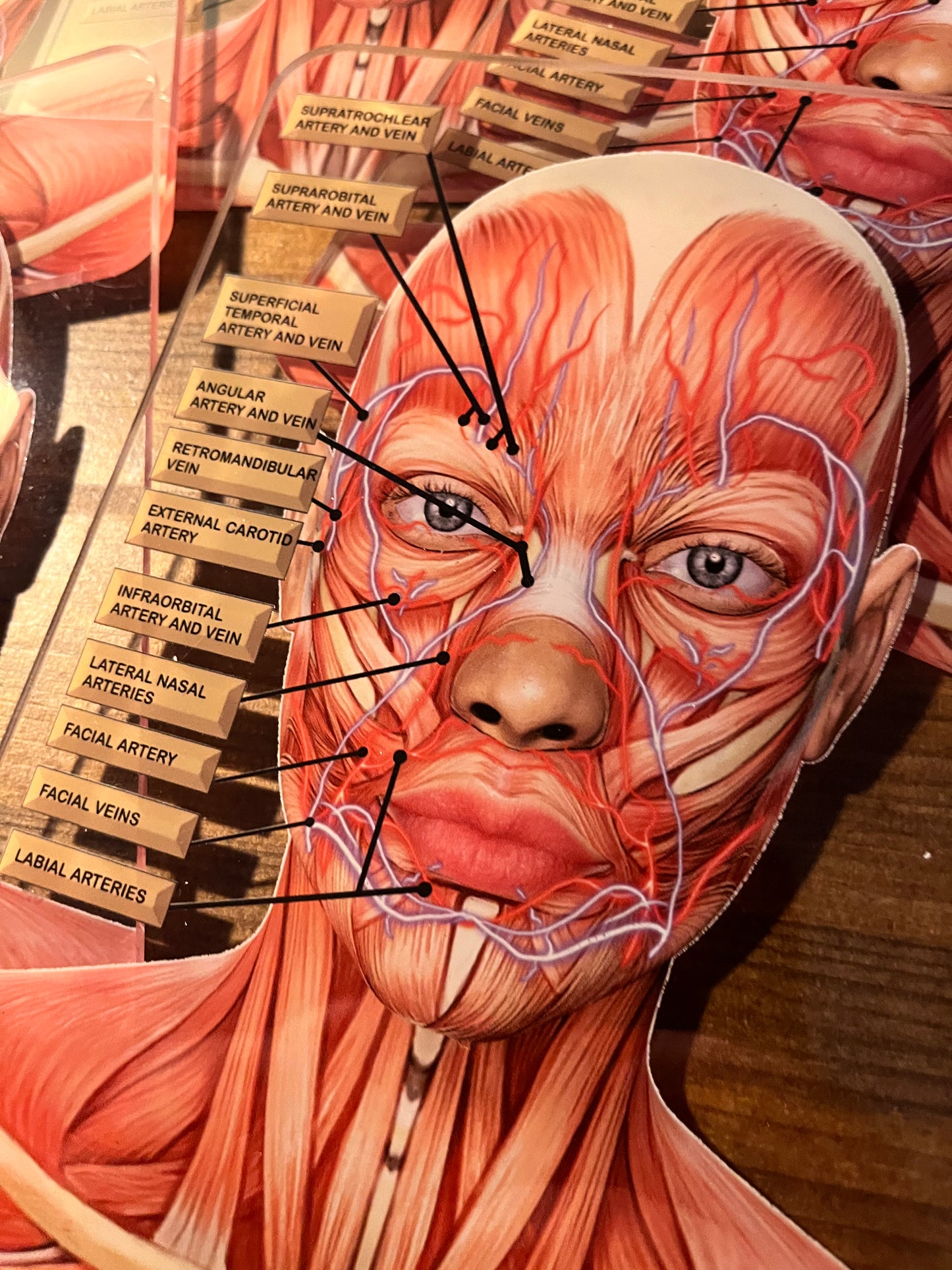 MINI's - Aesthetics Training Academy / Consultation Facial Anatomy Graphic for Veins And Arteries. Botox & Filler