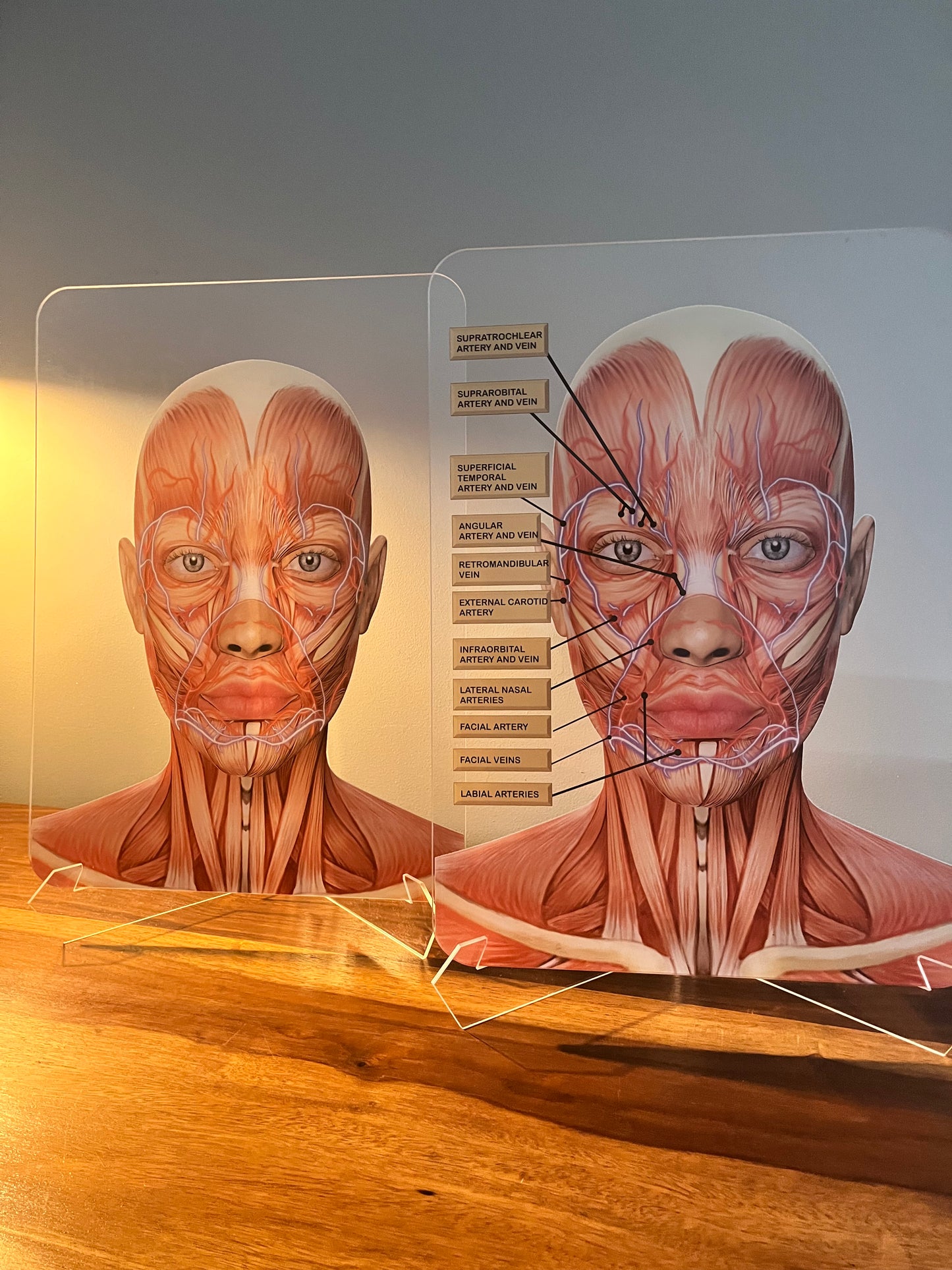 Aesthetics Training Academy / Consultation Facial Anatomy Graphic for Veins And Arteries.  Botox & Filler