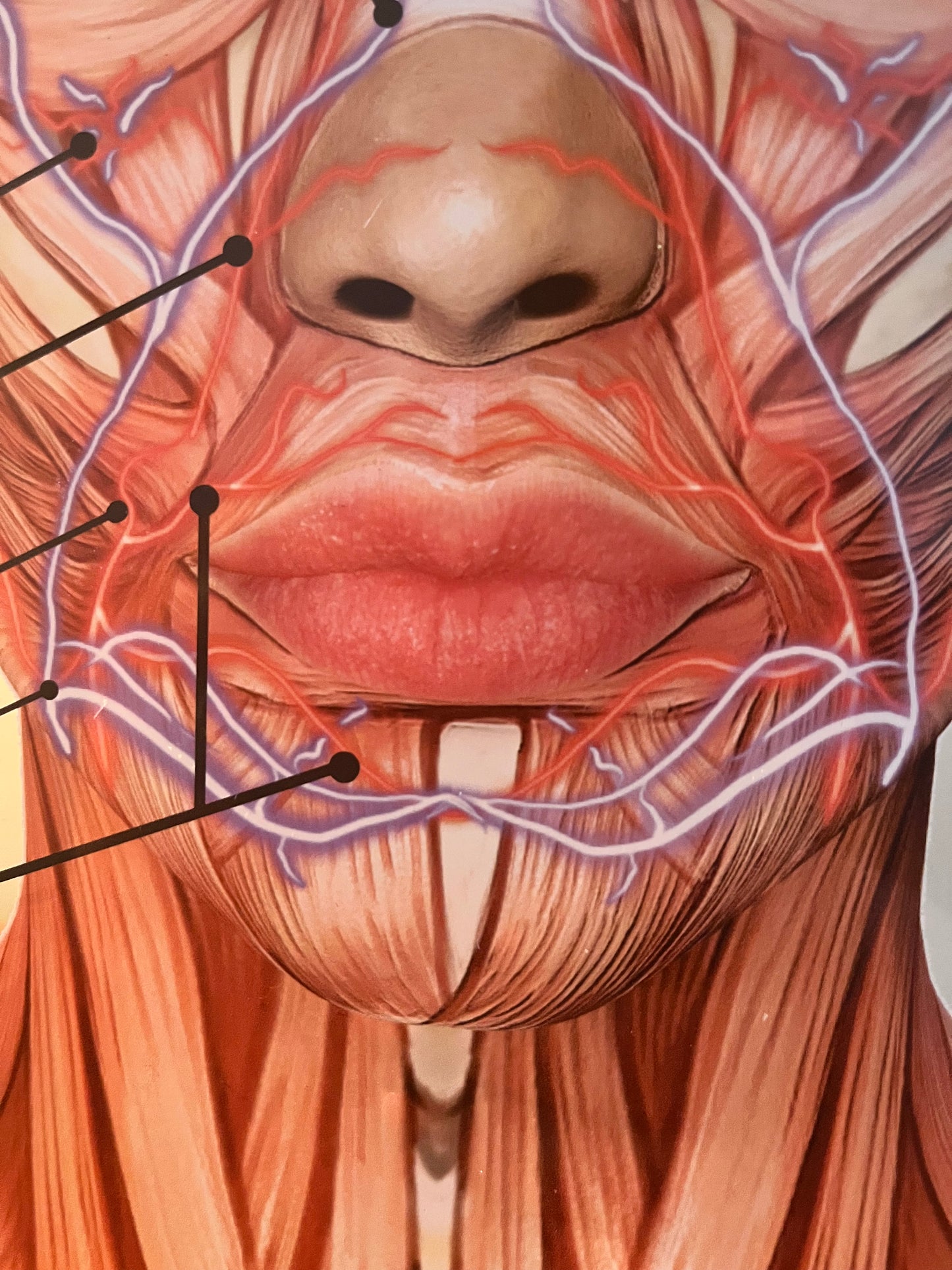 Aesthetics Training Academy / Consultation Facial Anatomy Graphic for Veins And Arteries.  Botox & Filler